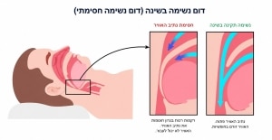 אינפוגרפיקה - מהו דום נשימה?